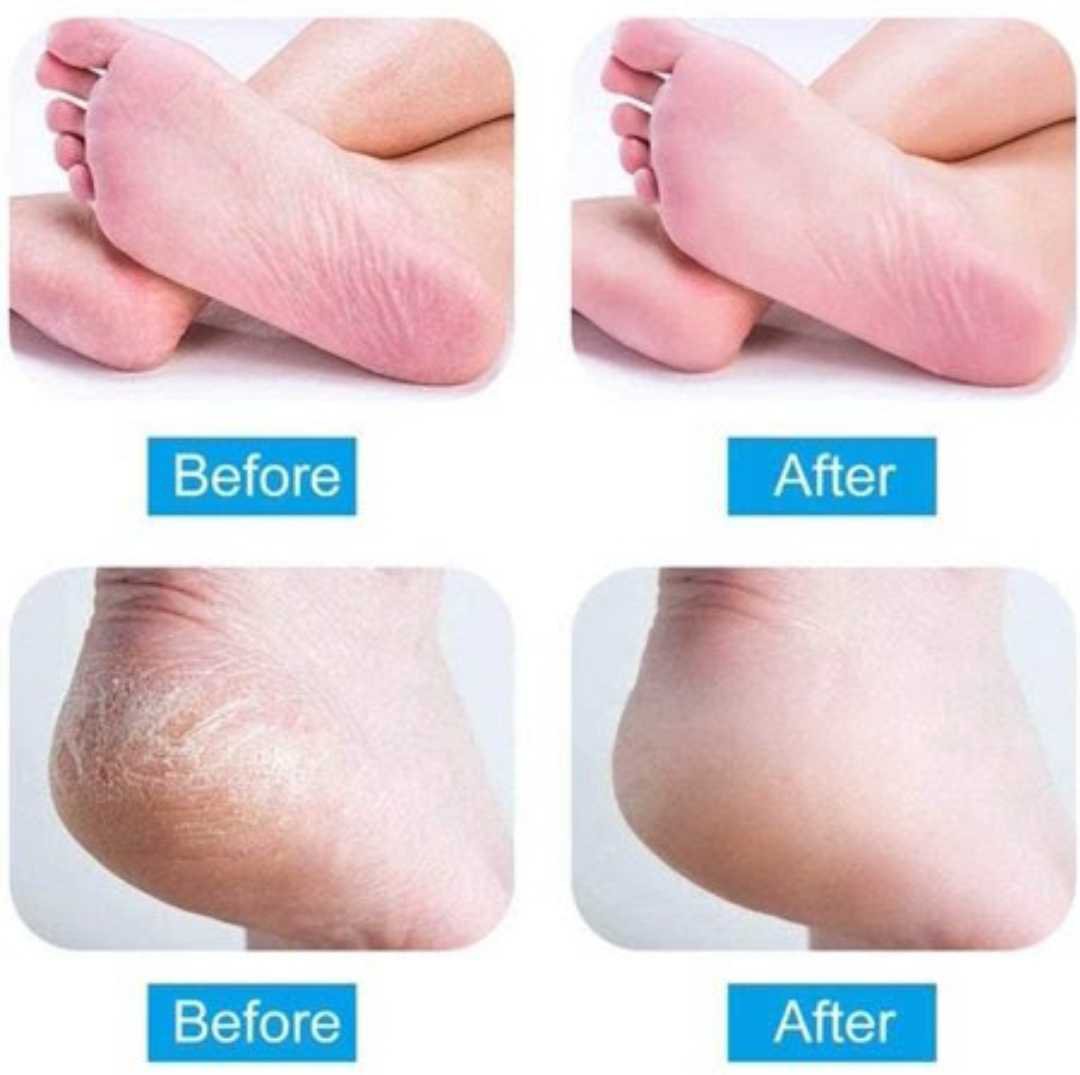 Pedi Vac - الصورة 3